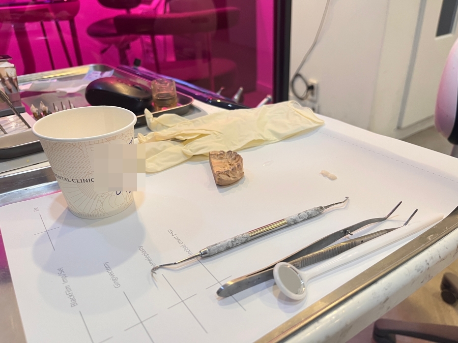 2D 치과 무삭제 라미네이트 접착전